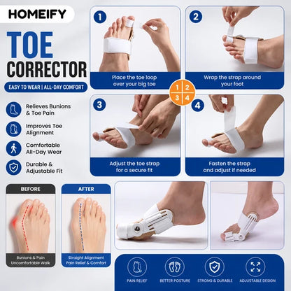 𝐇𝐞𝐚𝐥𝐭𝐡𝐂𝐚𝐫𝐞™ Bunion Corrector - مسكن ومصحح لورم إبهام القدم