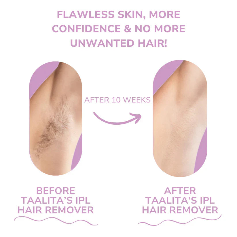 🎁 Today Promotion - 𝐁𝐞𝐚𝐮𝐭𝐲𝐏𝐥𝐮𝐬 𝐈𝐏𝐋 𝐇𝐚𝐢𝐫 𝐑𝐞𝐦𝐨𝐯𝐞𝐫 I The Leading Laser Hair Removal