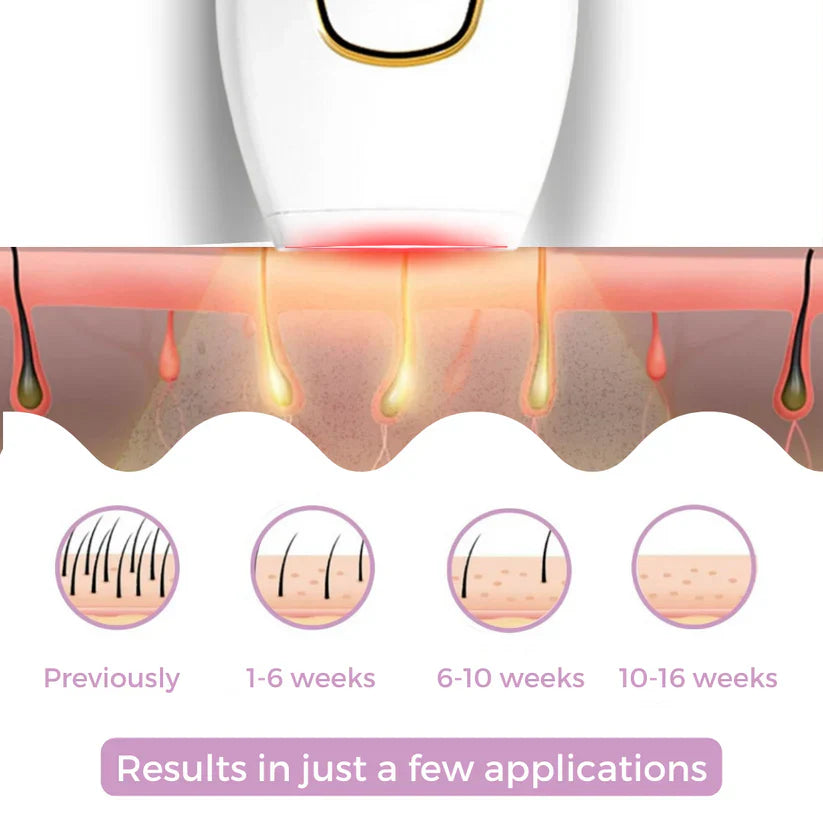 🎁 Today Promotion - 𝐁𝐞𝐚𝐮𝐭𝐲𝐏𝐥𝐮𝐬 𝐈𝐏𝐋 𝐇𝐚𝐢𝐫 𝐑𝐞𝐦𝐨𝐯𝐞𝐫 I The Leading Laser Hair Removal